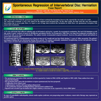 제22차 대한척추신경외과학회 정기학술대회 - 포스터 발표 이미지