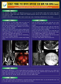 제50차 대한통증학회 학술대회 및 연수 교육 - 포스터발표 이미지