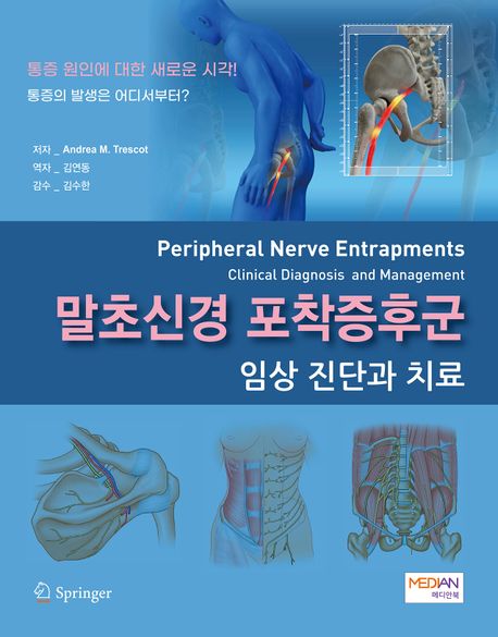 말초신경 포착증후군 이미지